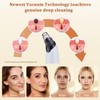 Xamoca Blackhead Remover Vacuum - Powerful Pore Vacuum for Cleansing,
