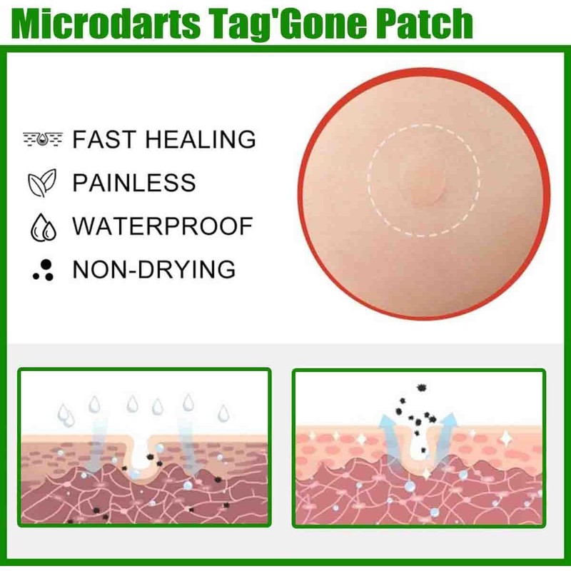 Microdarts Tag'gone Nano Patch,Natural Skin and Face Care Patch，2pc