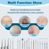 20 pcs Pimple Popper Tool Kit, Black Head Remover for