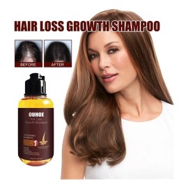Champú X Hair Growth, Champú Para Engrosar El Cabello, Anti-