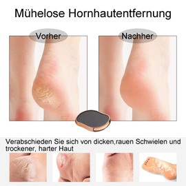 2-in-1 Nano Glass Callus Remover, Extremely Effective Callus Removal by Callus Remover for Foot and Hand, Callus File for Perfect Foot Care, Wet and Dry for Women or Men