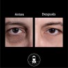 Kit Crecimiento Capilar + Antiojeras | Anti Caída + Bolsas