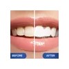 Lápiz Blanqueador Dental Venus Visage, Galardonado, Con Más