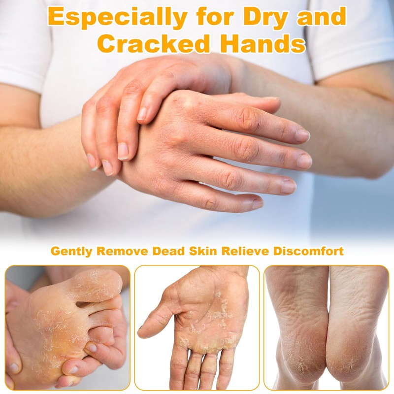 Ruichi 2Stück Hydrating and Anti-Cracking Foot Cream, Urea Creme 60%