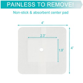Feeding Tube Adhesive Wound Dressing Sponge Split Drain Bandage for Peg G J Supra-Pubic Incision Bordered Guaze Pad Off-Cut Catheter Stabilization Device Holder Post Surgery 4"X 4", Pack of 10