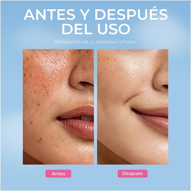 ULTRAMO Bruma Facial Mist Facial Hidratación Profunda Y Firmeza
