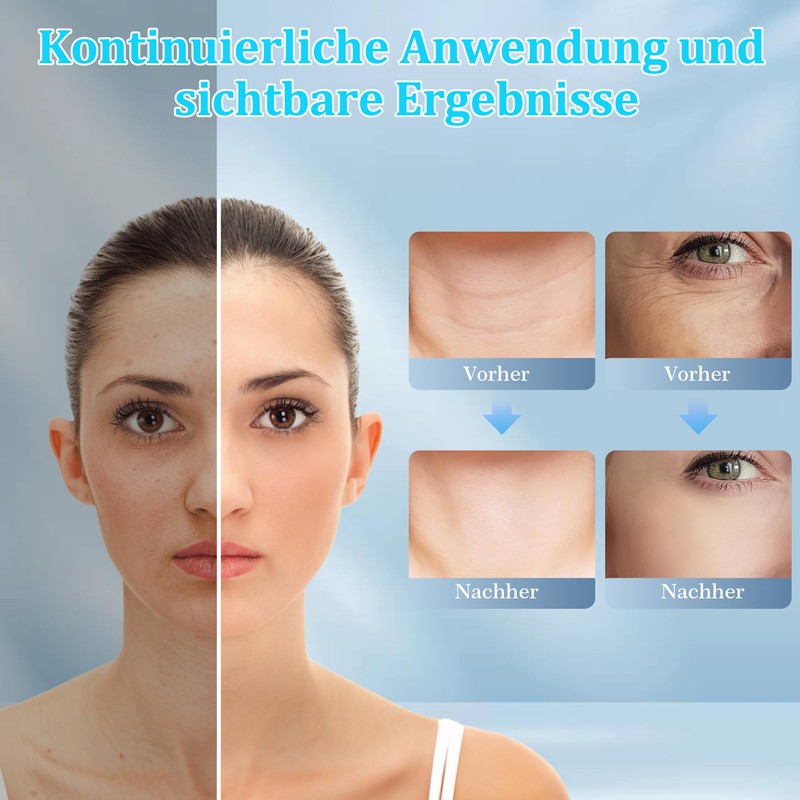 Yeerain Face Massager Against Wrinkles, EMS Face Massager with 4