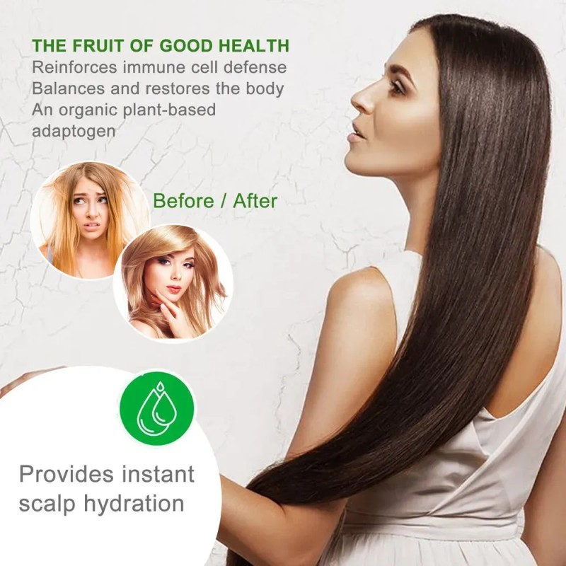 Mzl Aceite Capilar Amla Oil For Crecimiento Cabello