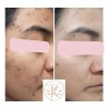 Crema Para El Rostro La Favorita