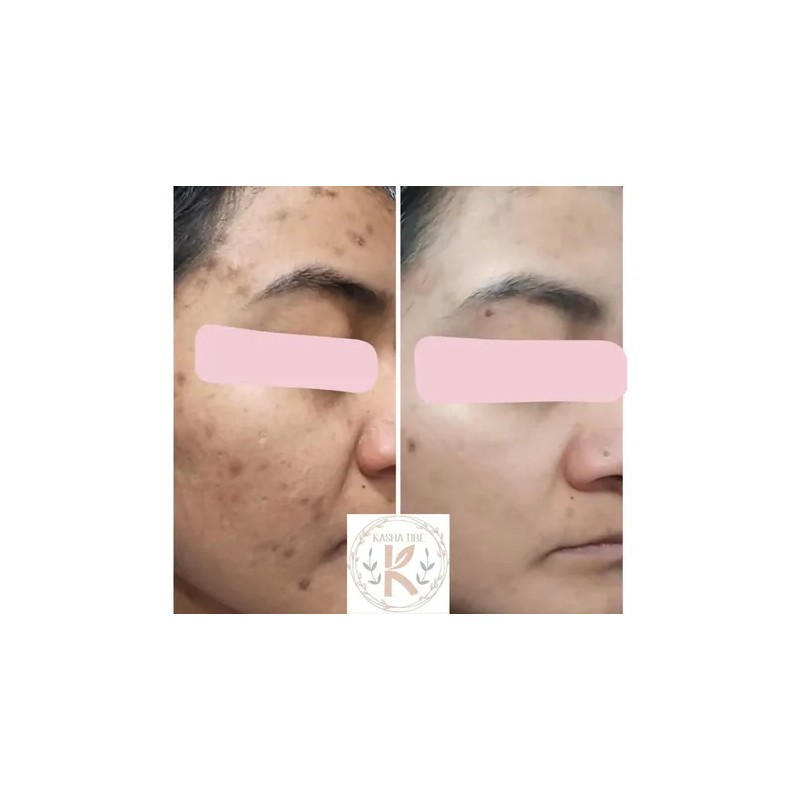 Crema Para El Rostro La Favorita