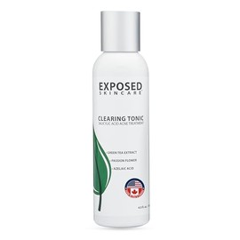 Acne Clearing Tonic Treatment Toner by Exposed Skin Care, Salicylic Acid 1 with Green Tea Extract                                                     