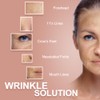 Akissos Face Tape Wrinkle Patches Forehead and Between Eyes Facial