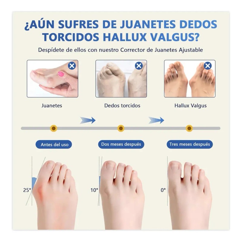 Kit De 24 Pares Corrector Protector De Juanetes Y Separador
