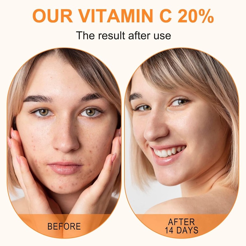 Maani Essence Premium 20% Vitamin C Serum For Face with