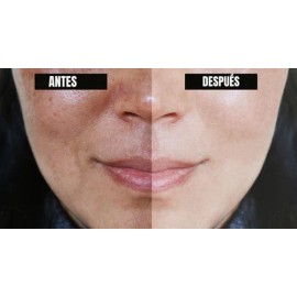 The Ordinary Glycolic Acid 7% Toning Solution Tónico 240ml M Todo Tipo De Piel Noche