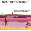 Scar Aid (pro-sil) Gel Silicón En Lápiz Para Cicatrices