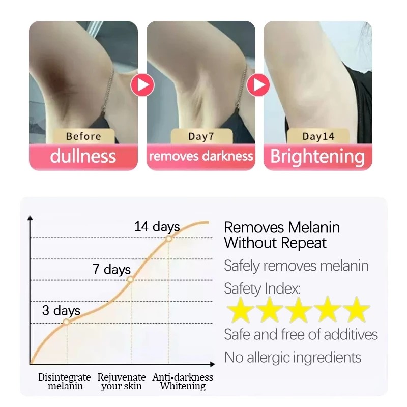 LYDIMOON Underarm melanin removal cream Neck/armpit/elbow/Black acanthoderm precipitation desalination private