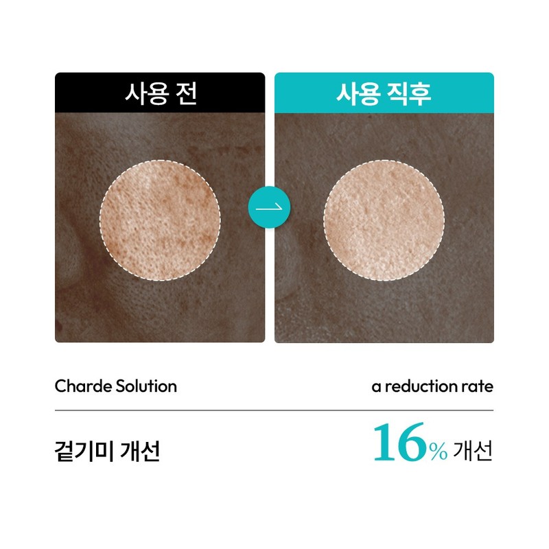 Shard Melacare Peel Cream Mask + Brush + Snow Ampoule