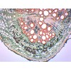 Legume Root Nodule - Prepared Microscope Slide - 75 x