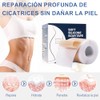 4M Parches de Silicona para Cicatrices, Cinta Medica Reutilizable Cuidado