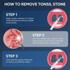 Tonsil Stone Remover with Camera - Upgraded Visual Tonsil Stone