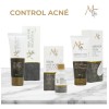 Kit Control Acné Piezas Life Limpiador Serum Crema Cara