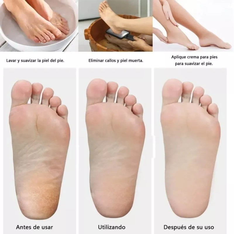 Lima Doble Cara Acero Inoxidable Para Exfoliar Pies Spa