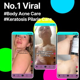 SOME BY MI AHA BHA PHA 30 Days Miracle Acne Clear Body Cleanser – 13.5oz, 400ml – Daily Exfoliating Tea Tree & Salicylic Acid Acne Body Wash – Deep Cleanses Sebum, Oil & Impurities – Korean Skin Care