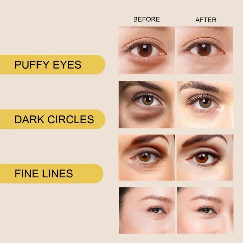 Mopoyat Parches Ojos Ácido