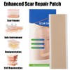 Silicone Scar Sheets 1.6" x 6" Silicone Scar Tape for