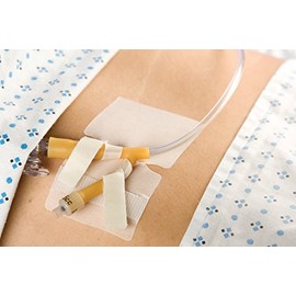 MJ54454EA - CATH-SECURE Dual Tab Multi-Purpose Tube Anchoring Device