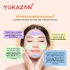 Yukazan Derma Refining Cream Acne & Pore 30ml Acne Removal