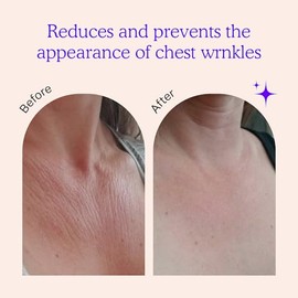 Almohadillas Arrugas Pecho Antienvejecimiento Tensar Piel Reafirmar Hidratar Líneas Finas Parches Silicona Seguros Reutilizables Durante Noche Más