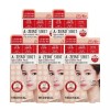 Medihill 메디힐 에이제로샷 트러블 드레싱 스팟 패치 80회용 X5개 Mediheal Azeroshot Trouble Dressing Spot Patch 80EA x 5 [80-Count Spot Patch X5 Free]