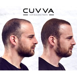 Hair Building Fibers by CUVVA for Fine & Thinning Hair (WHITE) - Thicker Looking Hair in 15 Seconds - 10 Different Shades for Men & Women - 0.87oz