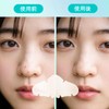 CICA Patch, Sensitive Skin, Day & Night Use, Rough Skin,
