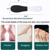 AIFUFAND -Pedicure foot spa kit (3 Piece set):_Barely noticeable symptoms(1