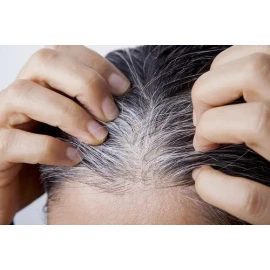 2 Tratamiento Cabello Al Tinte Sheló Matiza Elimina Canas
