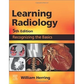 Learning Radiology: Recognizing the Basics