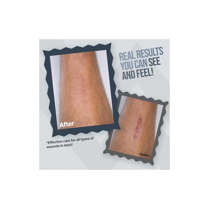 WoundWorx Silver Wound Dressing Gel – Non-Toxic Skin Care