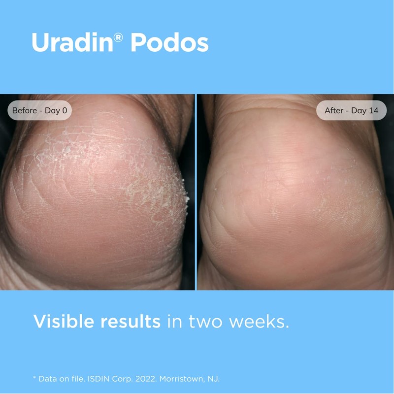 Crema para Cuidado de Pies Isdin Uradin Podos en Gel
