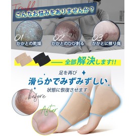 YUMISS Heel Care Socks, Heel Moisturizing Socks, 3 Times Moisturizing Effect, Maximizes Moisturizing, No Foreign Body Feeling When Worn, Skin Care, Slippery Heel Socks, Cracking Protection, Smooth