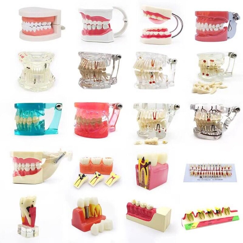 DentiForm 덴티폼 모형 위생사 재료상 모양 임플란트 기공사 입모형 [1
