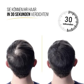 KAGOSHI Hair Fibre, 28 g, Hair Thickening, Hair Filler, Pouring Hair, Scattered Hair for Hair Thickening, Hair Powder, Hair Powder, Thickening, Instant Effect (Medium Brown)