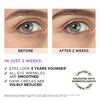 L'Oréal Paris, Eye Serum, Energising & Smoothing, Revitalift Filler 2.5%