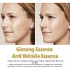 Ginseng Polypeptide Anti-Ageing Essence, Ginseng Extract Anti Wrinkle Serum, Ginseng