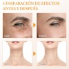 Gua Sha, Herramienta de Masaje de Acero Inoxidable Guasha, Herramienta