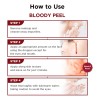 Solución Exfoliante Skin1004 Bloody Peel Aha 17% 30 Ml