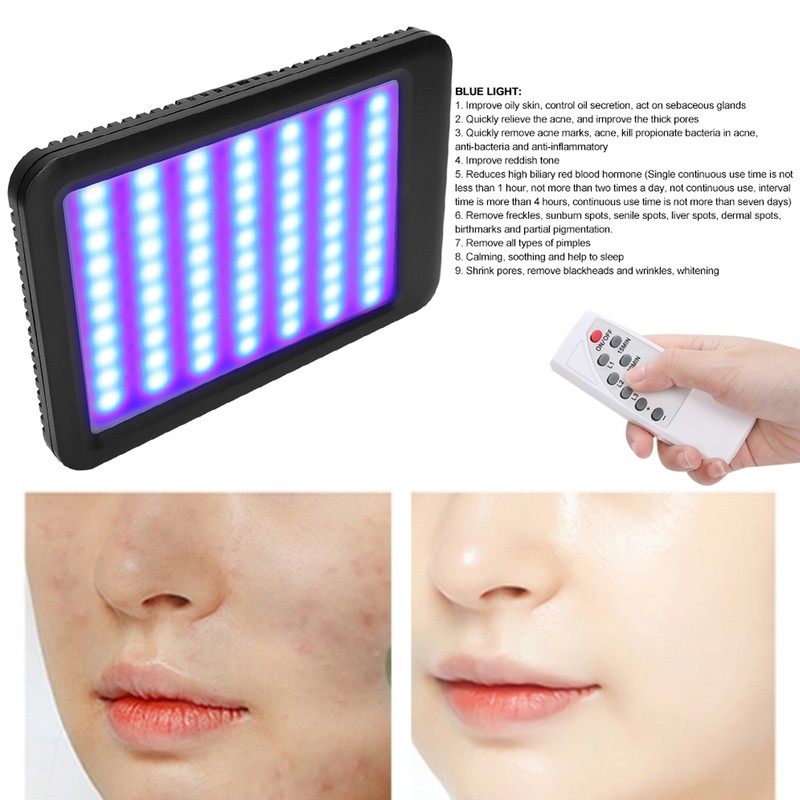 Red Blue Light Therapy Acne Removal Beauty Instrument Photon Skin