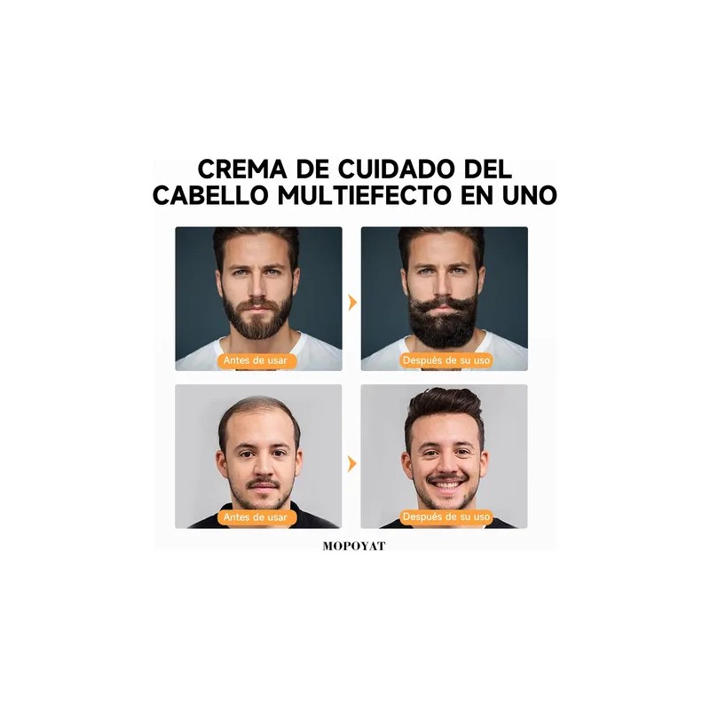 Crema Para El Crecimiento Del Cabello Y La Barba (20